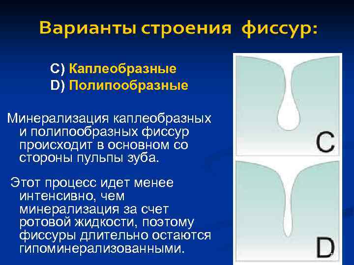 Показания к герметизации фиссур