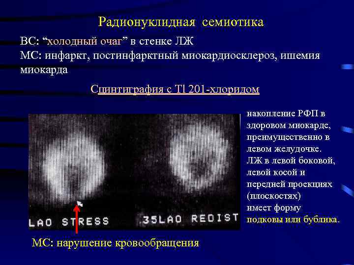 Радионуклидная визуализация