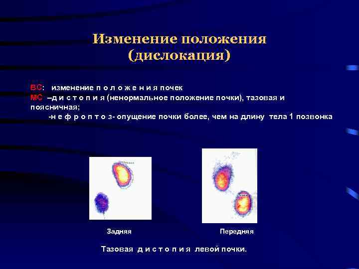 Изменение положения (дислокация) ВС: изменение п о л о ж е н и я