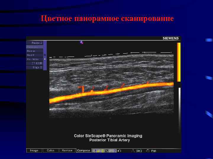 Цветное панорамное сканирование 