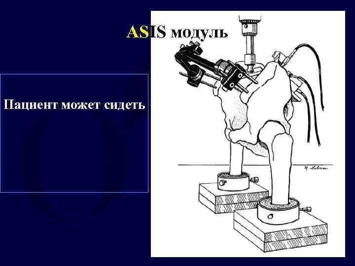 ASIS модуль Пациент может сидеть 