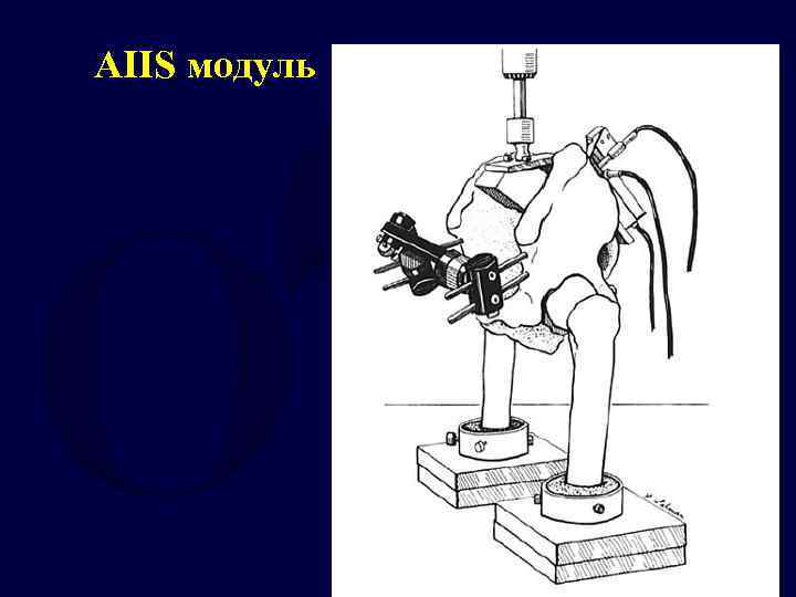 AIIS модуль 