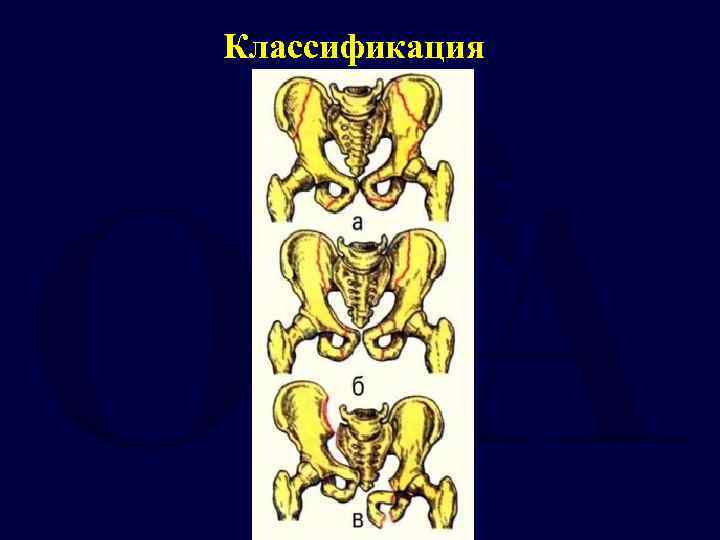 Классификация 