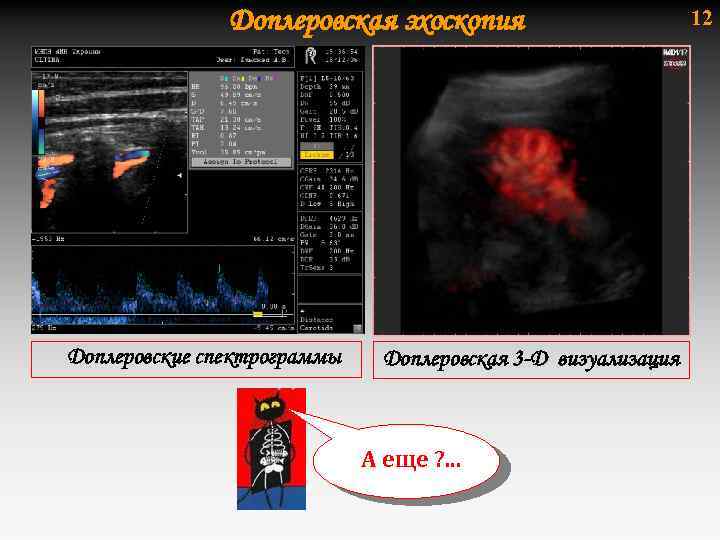 Доплеровская эхоскопия Доплеровские спектрограммы Доплеровская 3 -D визуализация А еще ? . . .