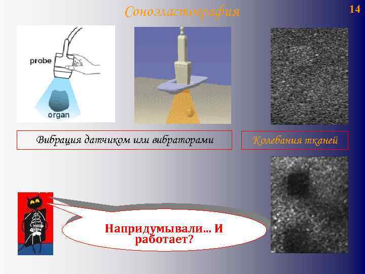14 Соноэластография Вибрация датчиком или вибраторами Напридумывали. . . И работает? Колебания тканей 