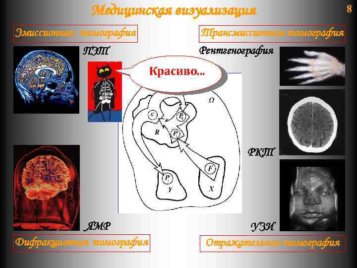 Медицинская визуализация Эмиссионная томография ПЭТ Трансмиссионная томография Рентгенография Красиво. . . РКТ ЯМР Дифракционная