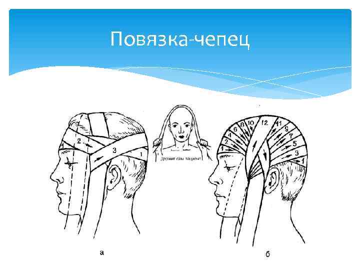 Повязка на голову чепец из бинта пошагово картинки с описанием