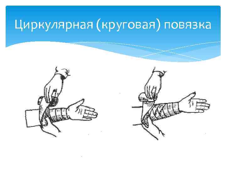 Циркулярная повязка картинка