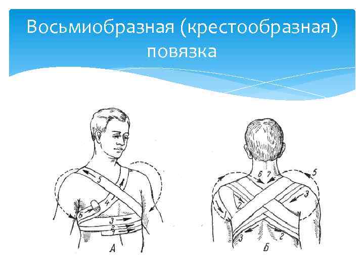 Восьмиобразная повязка. Восьмиобразная или крестообразная повязка. Десмургия восьмиобразная повязка. Крестообразная (восьмиобразная) повязка. Крестообразная (восьмиобразная) перевязка.