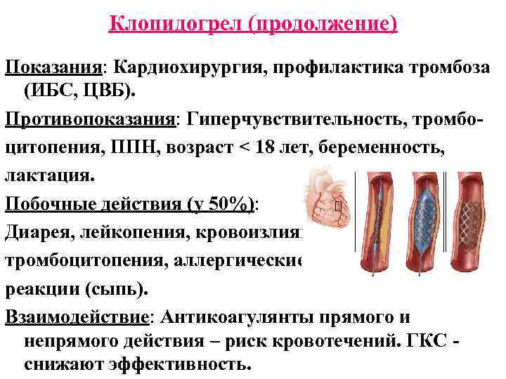 Клопидогрел (продолжение) Показания: Кардиохирургия, профилактика тромбоза (ИБС, ЦВБ). Противопоказания: Гиперчувствительность, тромбоцитопения, ППН, возраст <
