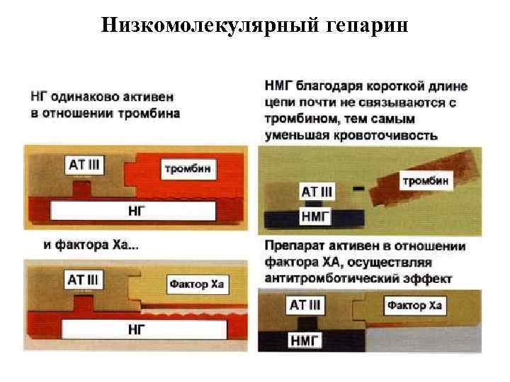 Низкомолекулярный гепарин 
