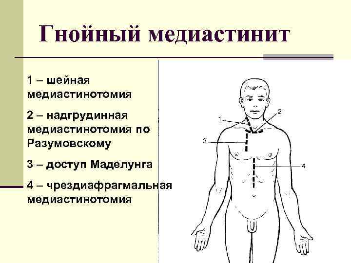 Цель которая достигается в результате построения ресурсного профиля проекта