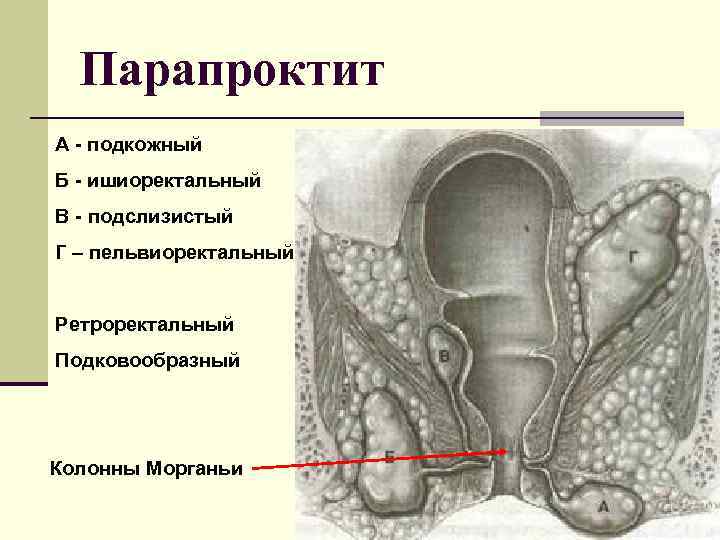 Ректальная железа