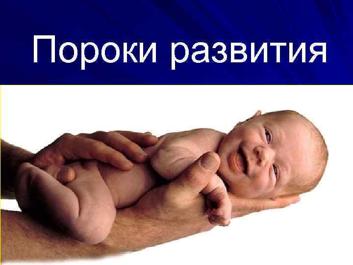 Пороки развития 