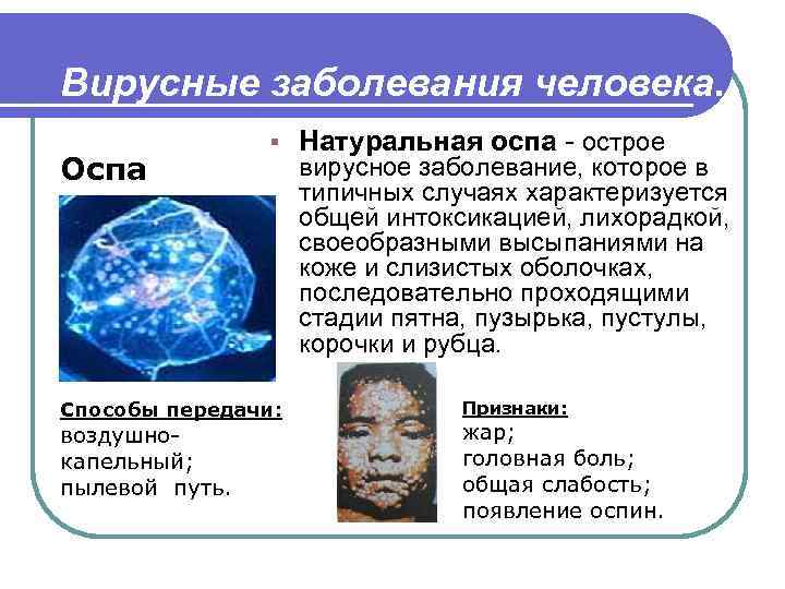 Вирусные заболевания человека. Оспа § Способы передачи: воздушнокапельный; пылевой путь. Натуральная оспа - острое