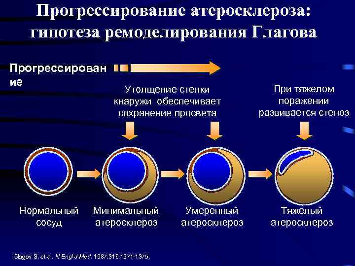 Ремоделирование сосудистой стенки