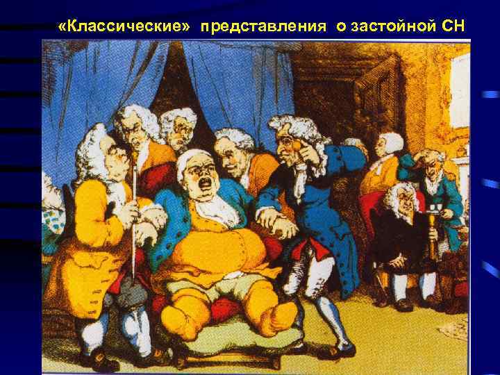  «Классические» представления о застойной СН 