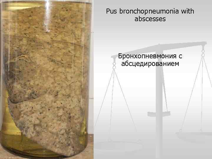 Pus bronchopneumonia with abscesses Бронхопневмония с абсцедированием 