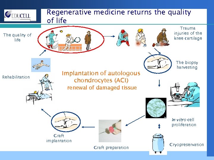 Regenerative medicine returns the quality of life Trauma injuries of the knee cartilage The