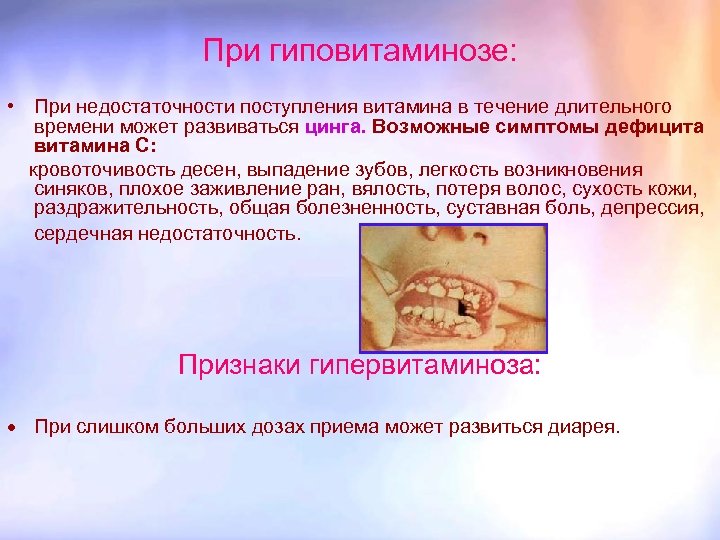 При гиповитаминозе: • При недостаточности поступления витамина в течение длительного времени может развиваться цинга.