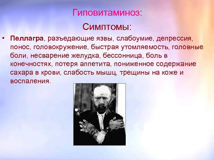 Гиповитаминоз: Симптомы: • Пеллагра, разъедающие язвы, слабоумие, депрессия, понос, головокружение, быстрая утомляемость, головные боли,