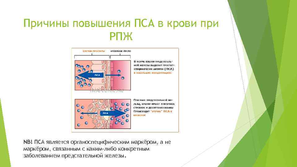 Причины повышения ПСА в крови при РПЖ NB! ПСА является органоспецифическим маркёром, а не