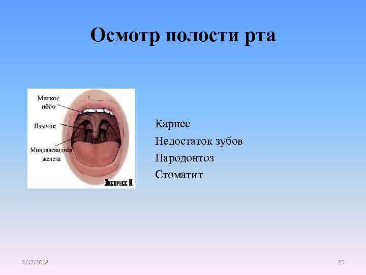 Осмотр полости рта Кариес Недостаток зубов Пародонтоз Стоматит 2/17/2018 25 