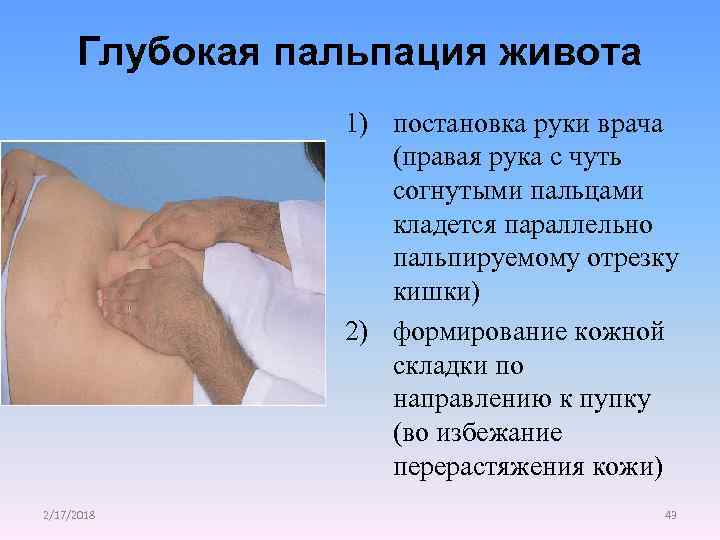 Глубокая пальпация живота 1) постановка руки врача (правая рука с чуть согнутыми пальцами кладется