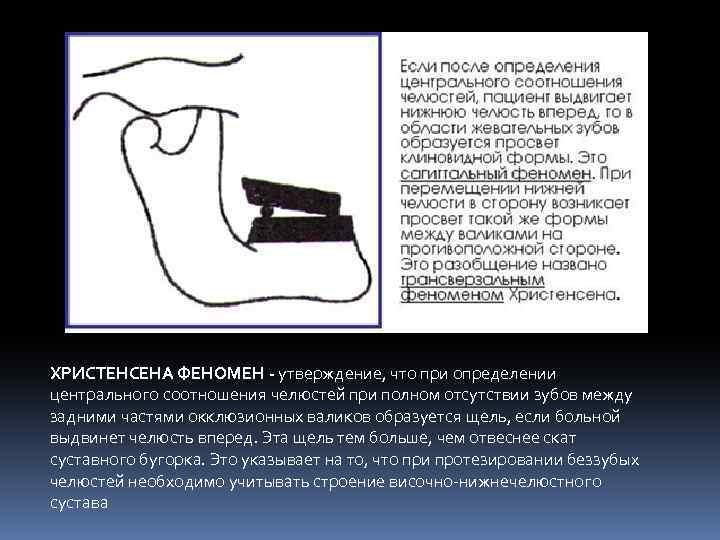 Этапы определение центрального соотношения