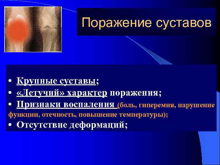 Поражение суставов • Крупные суставы; • «Летучий» характер поражения; • Признаки воспаления (боль, гиперемия,