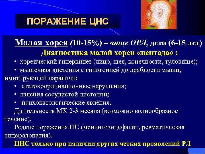 ПОРАЖЕНИЕ ЦНС Малая хорея (10 -15%) – чаще ОРЛ, дети (6 -15 лет) Диагностика