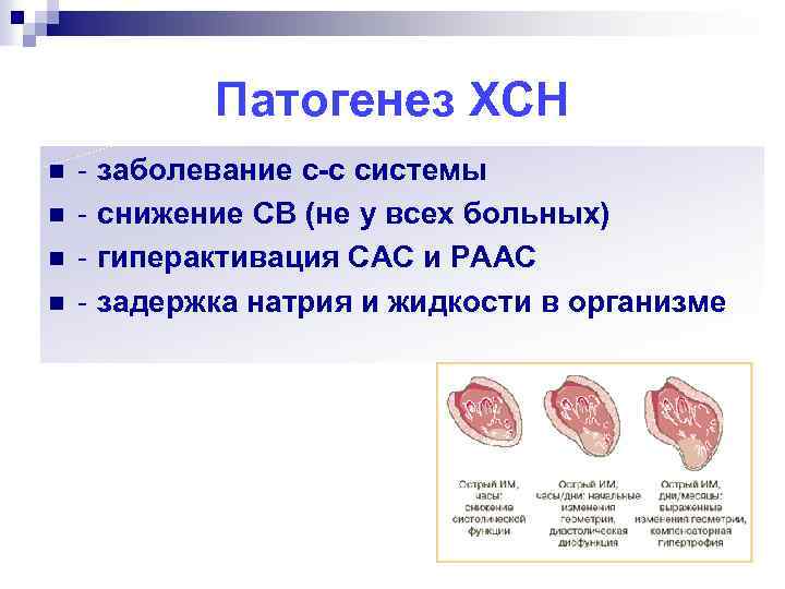 Патогенез ХСН n n - заболевание с-с системы - снижение СВ (не у всех