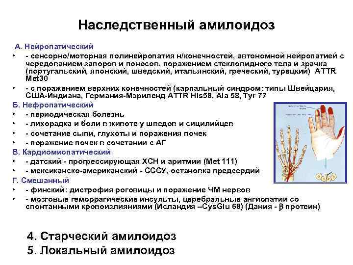 Наследственный амилоидоз A. Нейропатический • - сенсорно/моторная полинейропатия н/конечностей, автономной нейропатией с чередованием запоров