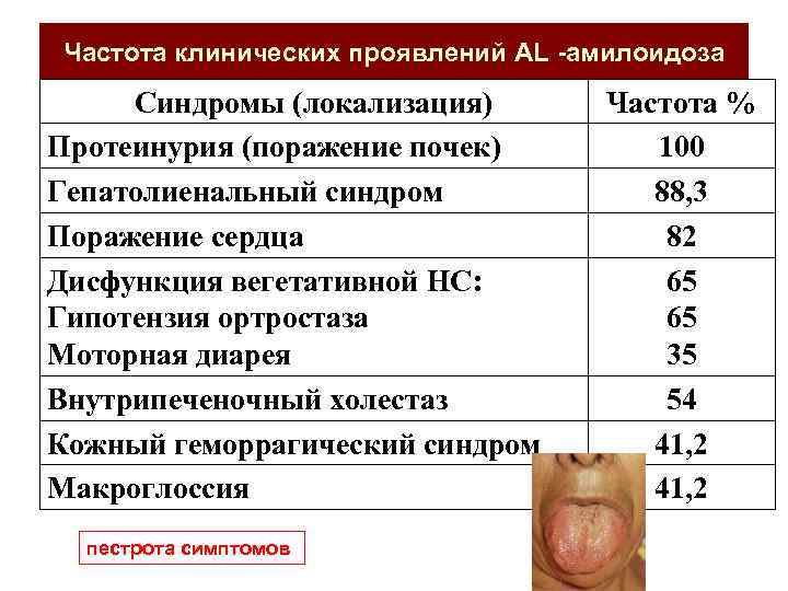 Частота клинических проявлений AL -амилоидоза Синдромы (локализация) Протеинурия (поражение почек) Гепатолиенальный синдром Поражение сердца