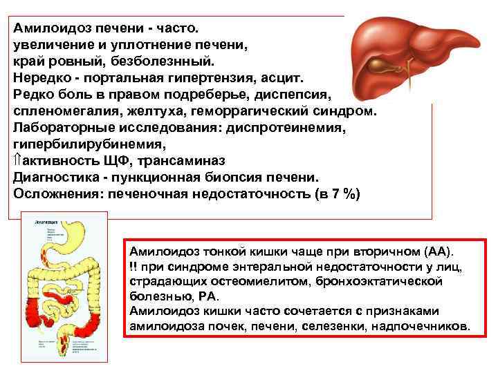 Амилоидоз печени - часто. увеличение и уплотнение печени, край ровный, безболезнный. Нередко - портальная