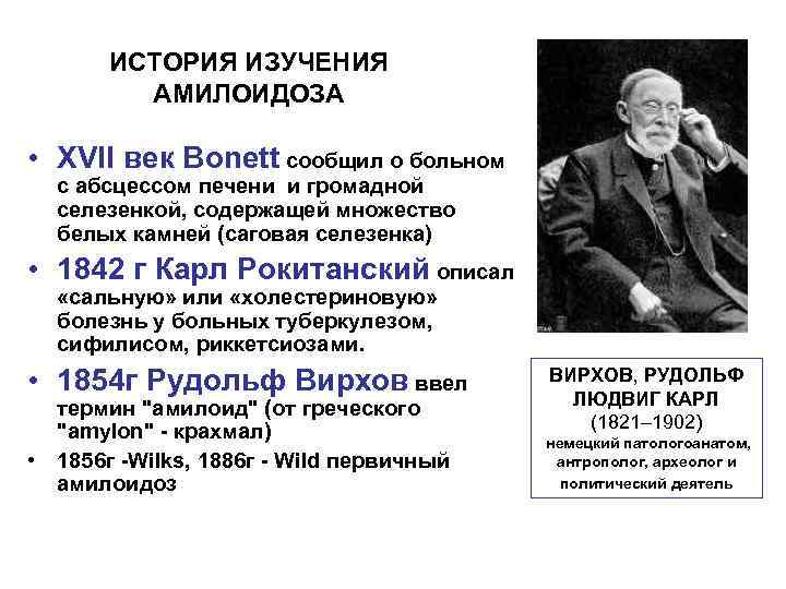 ИСТОРИЯ ИЗУЧЕНИЯ АМИЛОИДОЗА • XVII век Bonett сообщил о больном с абсцессом печени и