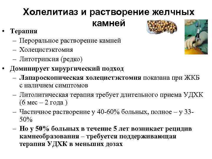 Холелитиаз и растворение желчных камней • Терапия – Пероральное растворение камней – Холецистэктомия –