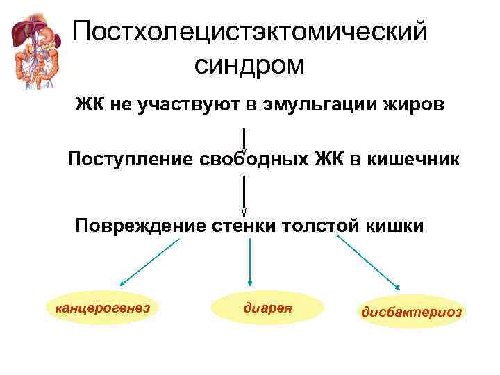 Постхолецистэктомический синдром ЖК не участвуют в эмульгации жиров Поступление свободных ЖК в кишечник Повреждение