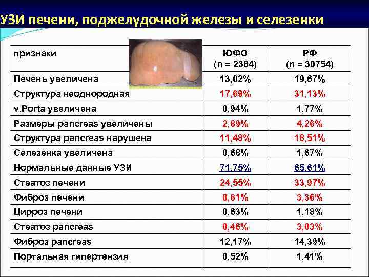 УЗИ печени, поджелудочной железы и селезенки признаки ЮФО (n = 2384) РФ (n =