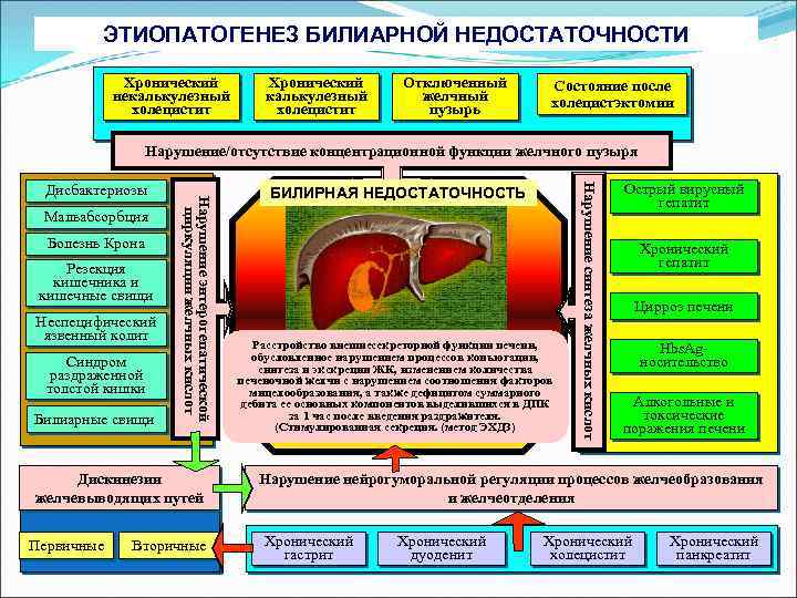 ЭТИОПАТОГЕНЕЗ БИЛИАРНОЙ НЕДОСТАТОЧНОСТИ Хронический некалькулезный холецистит Хронический калькулезный холецистит Отключенный желчный пузырь Состояние после