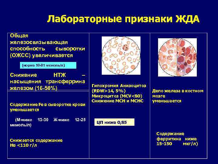 Лабораторные признаки. Лабораторные признаки железодефицитной анемии. Лабораторные критерии железодефицитной анемии. Норма ферритина и трансферрина. Лабораторные признаки жда.