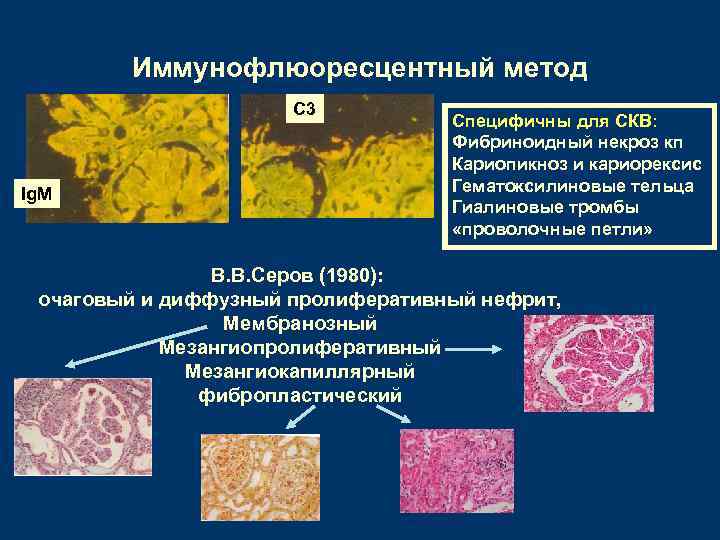 Иммунофлюоресцентный метод С 3 Ig. M Специфичны для СКВ: Фибриноидный некроз кп Кариопикноз и