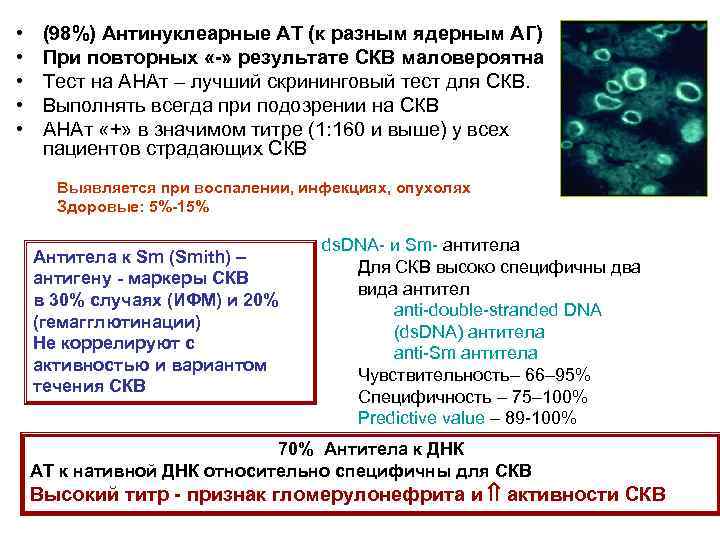  • • • (98%) Антинуклеарные АТ (к разным ядерным АГ) При повторных «-»