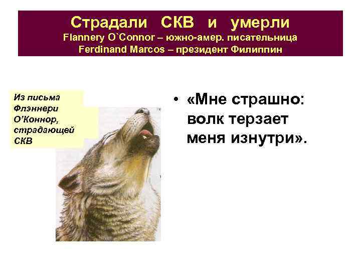 Страдали СКВ и умерли Flannery O`Connor – южно-амер. писательница Ferdinand Marcos – президент Филиппин
