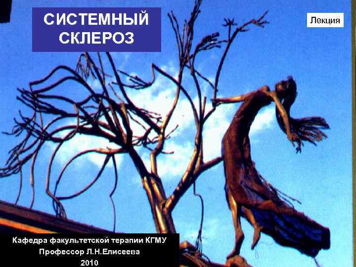 СИСТЕМНЫЙ СКЛЕРОЗ Кафедра факультетской терапии КГМУ Профессор Л. Н. Елисеева 2010 Лекция 