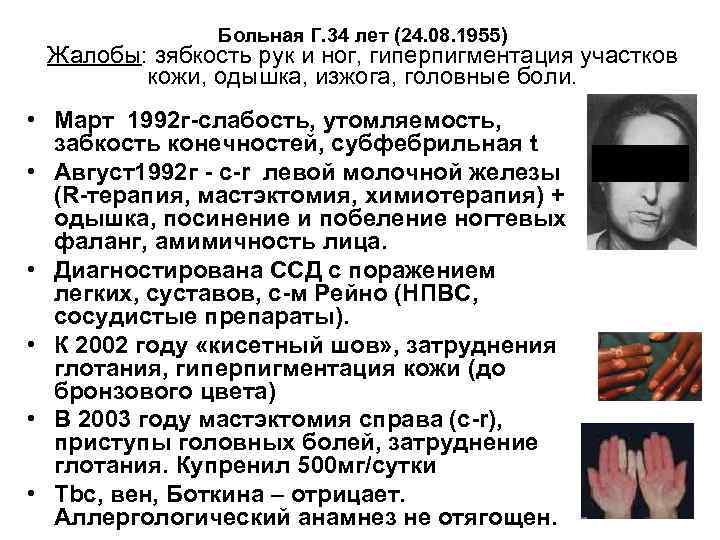 Больная Г. 34 лет (24. 08. 1955) Жалобы: зябкость рук и ног, гиперпигментация участков