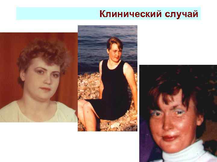 Клинический случай 