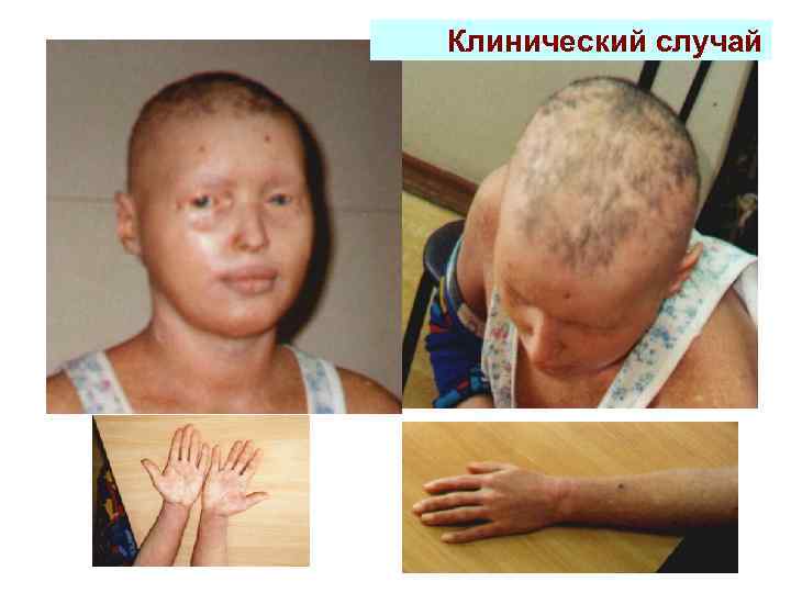 Клинический случай 