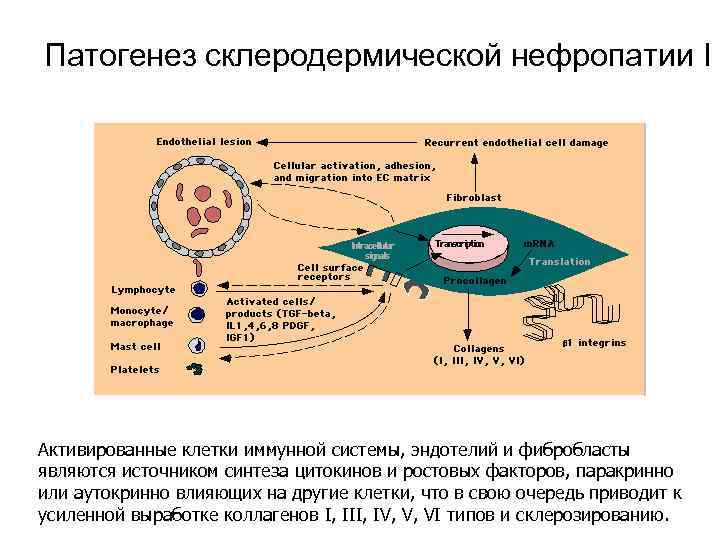 Патогенез склеродермической нефропатии I Активированные клетки иммунной системы, эндотелий и фибробласты являются источником синтеза