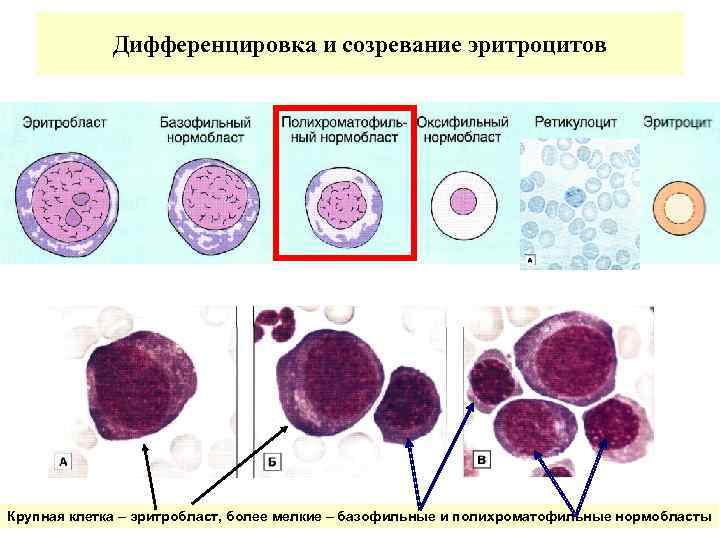 Дифференцировка и созревание эритроцитов Крупная клетка – эритробласт, более мелкие – базофильные и полихроматофильные